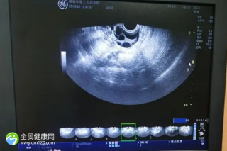 孕期怎么让体重降下去？想让体重降下去看过来